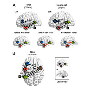 languages-brain